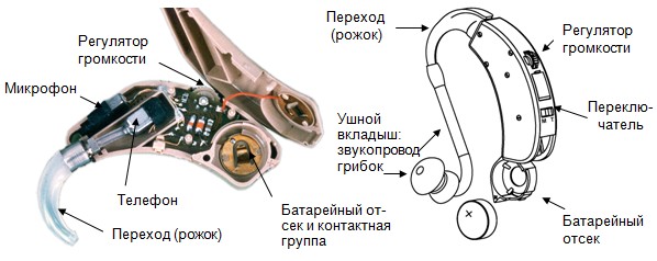 устройство слуховых аппаратов