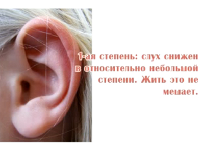 1 степень снижения слуха